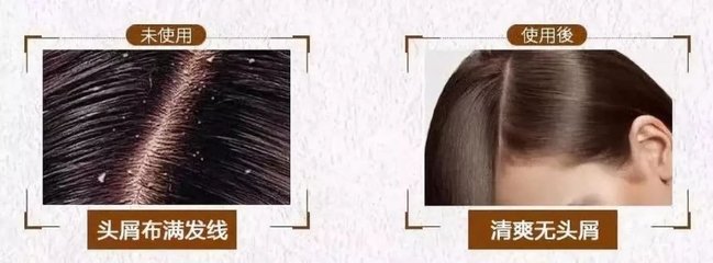 脫發、掉發、頭發稀少？用它洗洗，一次就離不開